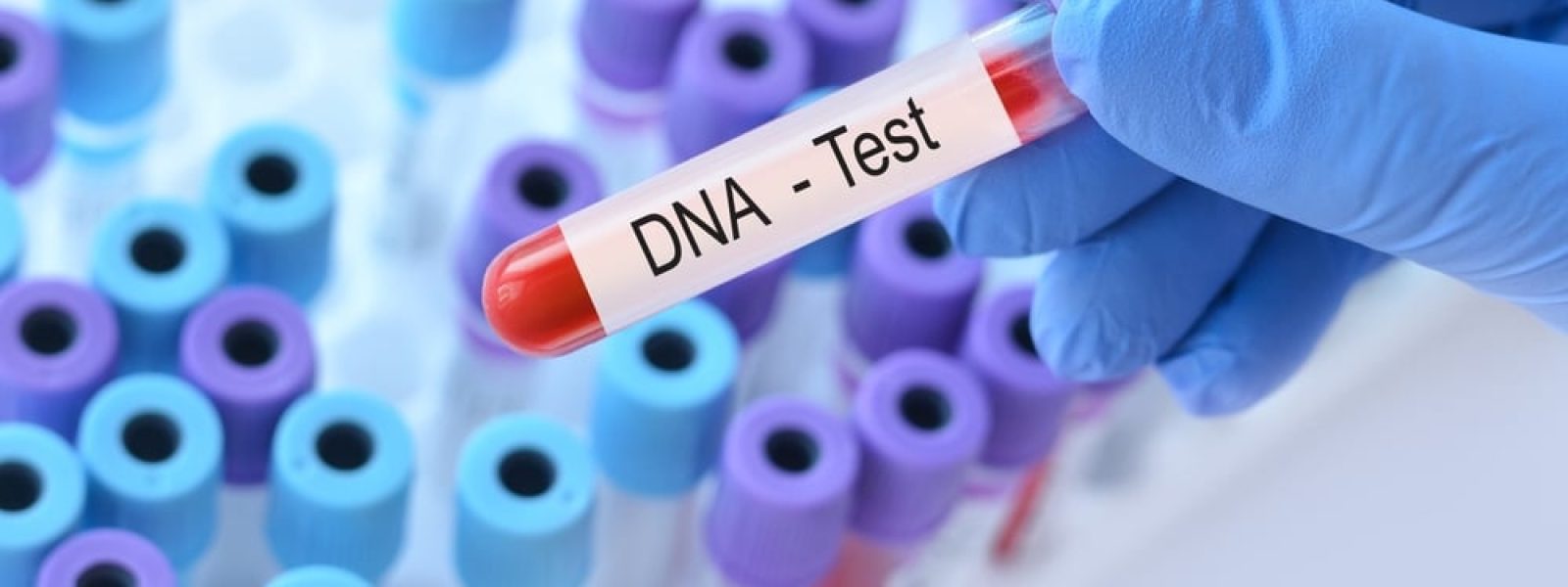 nea-apli-exetasi-DNA-provlepi Νέα απλή εξέταση DNA προβλέπει τον καρκίνο πριν εμφανιστεί