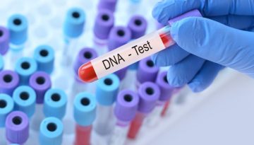 Νέα απλή εξέταση DNA προβλέπει τον καρκίνο πριν εμφανιστεί