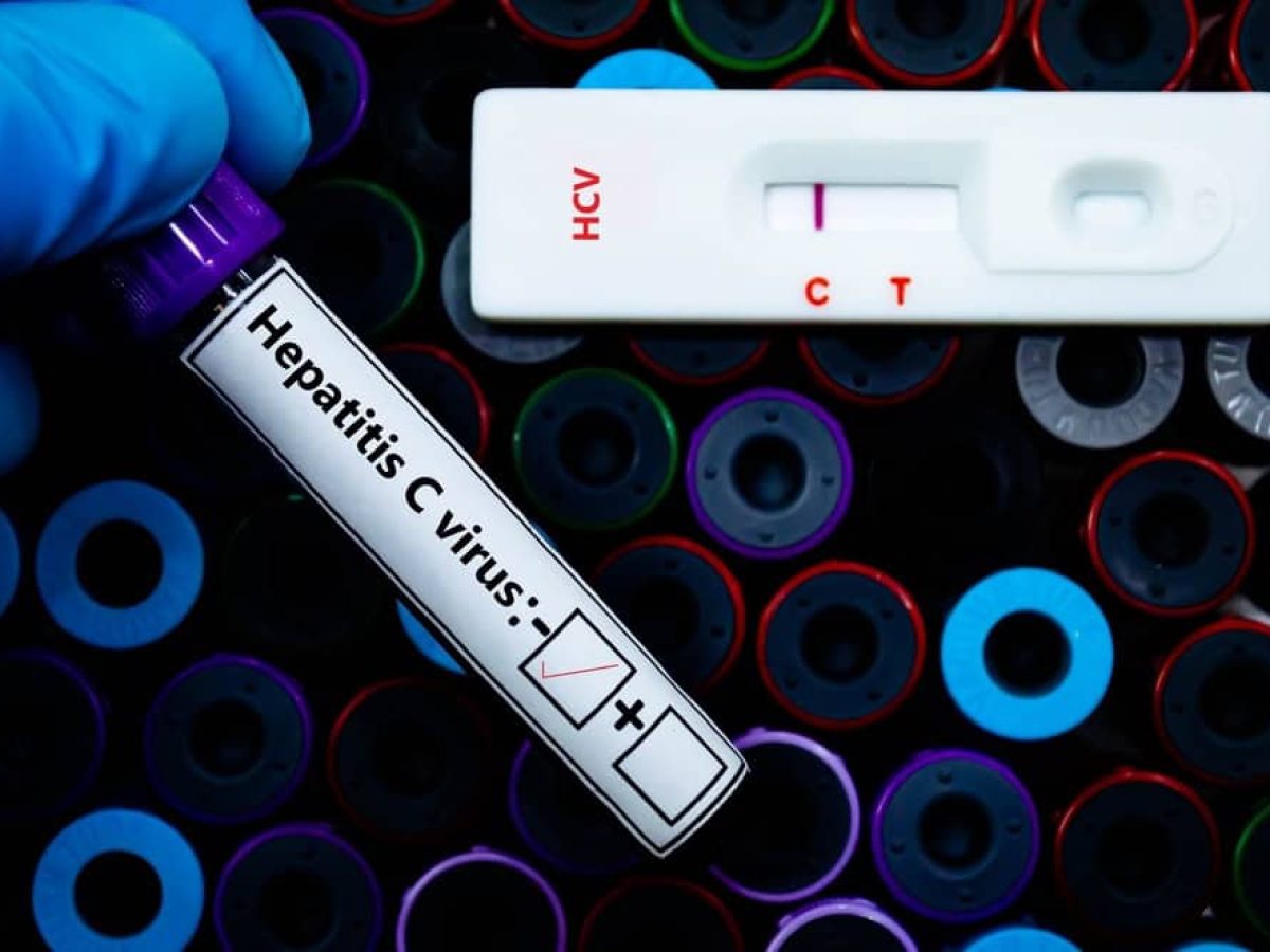 Ηπατίτιδα C και καρκίνος του παγκρέατος: Ένας νέος κρίκος στην αλυσίδα της πρόληψης