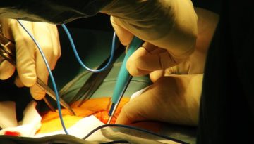 Χριστουγεννιάτικα δώρα ζωής – Το σήμερα και το αύριο των μεταμοσχεύσεων