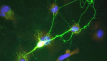 Η απογοήτευση μεταβάλλει τη χημεία του εγκεφάλου