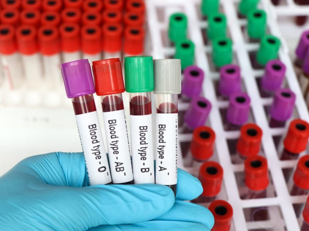 Τα πλεονεκτήματα και τα μειονεκτήματα των ομάδων αίματος Α, Β, ΑΒ, Ο – Ποιος διατρέχει μεγαλύτερο κίνδυνο για καρκίνο, νοροϊό και τσιμπήματα εντόμων