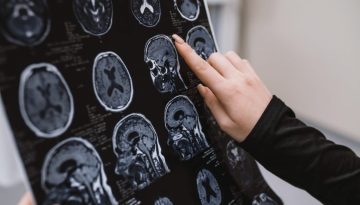&Alpha;&pi;ό&tau;&omicron;&mu;&eta; &alpha;ύ&xi;&eta;&sigma;&eta; &tau;&omicron;&upsilon; &sigma;&alpha;&kappa;&chi;ά&rho;&omicron;&upsilon; &sigma;&tau;&omicron; &alpha;ί&mu;&alpha; &sigma;&upsilon;&nu;&delta;έ&epsilon;&tau;&alpha;&iota; &mu;&epsilon; &upsilon;&psi;&eta;&lambda;ό&tau;&epsilon;&rho;&omicron; &kappa;ί&nu;&delta;&upsilon;&nu;&omicron; &Alpha;&lambda;&tau;&sigma;&chi;ά&iota;&mu;&epsilon;&rho;