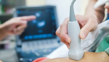 &Alpha;&xi;&omicron;&nu;&iota;&kappa;ή &sigma;&tau;&epsilon;&phi;&alpha;&nu;&iota;&omicron;&gamma;&rho;&alpha;&phi;ί&alpha; ή stress echo &gamma;&iota;&alpha; &tau;&eta;&nu; &alpha;&rho;&chi;&iota;&kappa;ή &delta;&iota;&epsilon;&rho;&epsilon;ύ&nu;&eta;&sigma;&eta; &tau;&eta;&sigmaf; &sigma;&tau;&epsilon;&phi;&alpha;&nu;&iota;&alpha;ί&alpha;&sigmaf; &nu;ό&sigma;&omicron;&upsilon;;