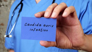 Candida auris: Ο «σιωπηλός» υπερμύκητας που εξαπλώνεται παγκοσμίως και θέτει σε συναγερμό τα συστήματα υγείας