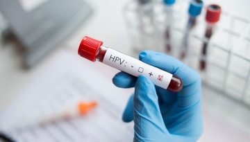 HPV: &Omicron; &iota;ό&sigmaf; &pi;&omicron;&upsilon; ό&lambda;&omicron;&iota; &gamma;&nu;&omega;&rho;ί&zeta;&omicron;&upsilon;&nu; &mdash;&alpha;&lambda;&lambda;ά &lambda;ί&gamma;&omicron;&iota; &kappa;&alpha;&tau;&alpha;&lambda;&alpha;&beta;&alpha;ί&nu;&omicron;&upsilon;&nu;