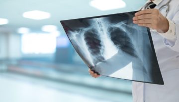 K&alpha;&rho;&kappa;ί&nu;&omicron;&sigmaf; &tau;&omicron;&upsilon; &pi;&nu;&epsilon;ύ&mu;&omicron;&nu;&alpha;: &Pi;ό&tau;&epsilon; &alpha;&nu;&alpha;&mu;έ&nu;&epsilon;&tau;&alpha;&iota; &tau;&omicron; &pi;&iota;&lambda;&omicron;&tau;&iota;&kappa;ό &pi;&rho;ό&gamma;&rho;&alpha;&mu;&mu;&alpha;  &pi;&rho;&omicron;&sigma;&upsilon;&mu;&pi;&tau;&omega;&mu;&alpha;&tau;&iota;&kappa;&omicron;ύ &epsilon;&lambda;έ&gamma;&chi;&omicron;&upsilon; &kappa;&alpha;&iota; &tau;&iota; &theta;&alpha; &pi;&epsilon;&rho;&iota;&lambda;&alpha;&mu;&beta;ά&nu;&epsilon;&iota;