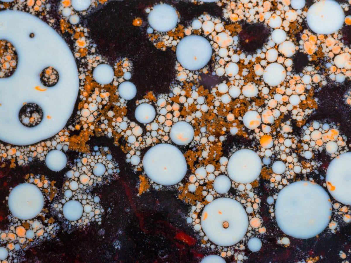 Επικίνδυνες αμοιβάδες εξαπλώνονται σε όλο τον κόσμο: Επείγουσα έκκληση των επιστημόνων για δράση