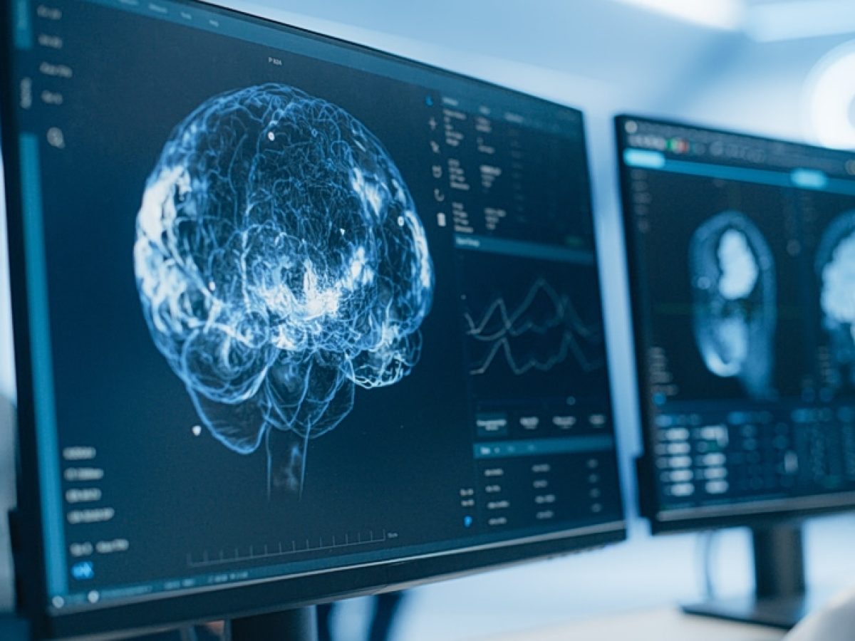 «Έσβησε» στα 24 από άνοια – Η δωρεά του ανοίγει νέους δρόμους στη νευροεπιστήμη