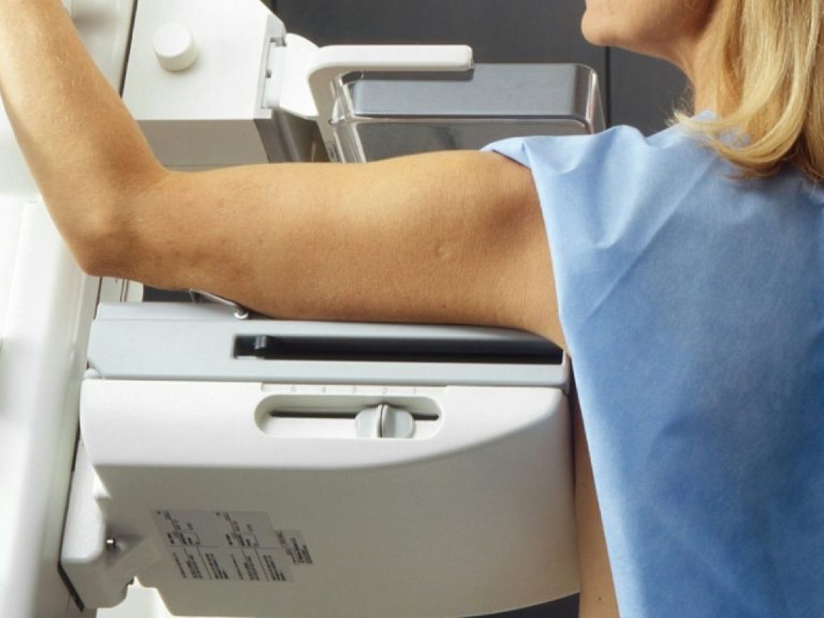 Καρκίνος του μαστού: Η τεχνητή νοημοσύνη βελτιώνει τον προληπτικό έλεγχο