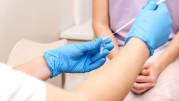 Καρκίνος τραχήλου μήτρας – Νέες οδηγίες πρόληψης και διάγνωσης με HPV τεστ και αυτοληψία δείγματος