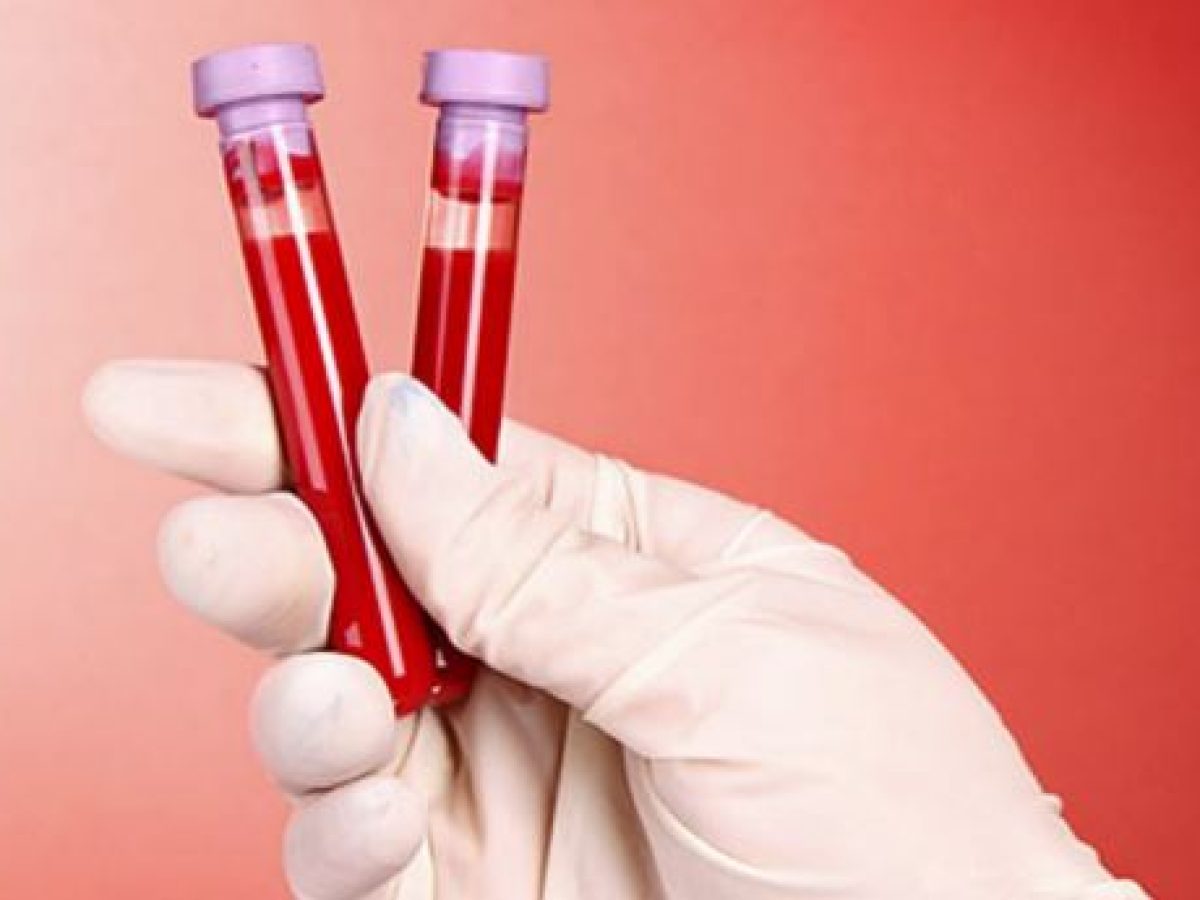 Μεταβολίτες στο αίμα προβλέπουν τον κίνδυνο για διαβήτη τύπου 2