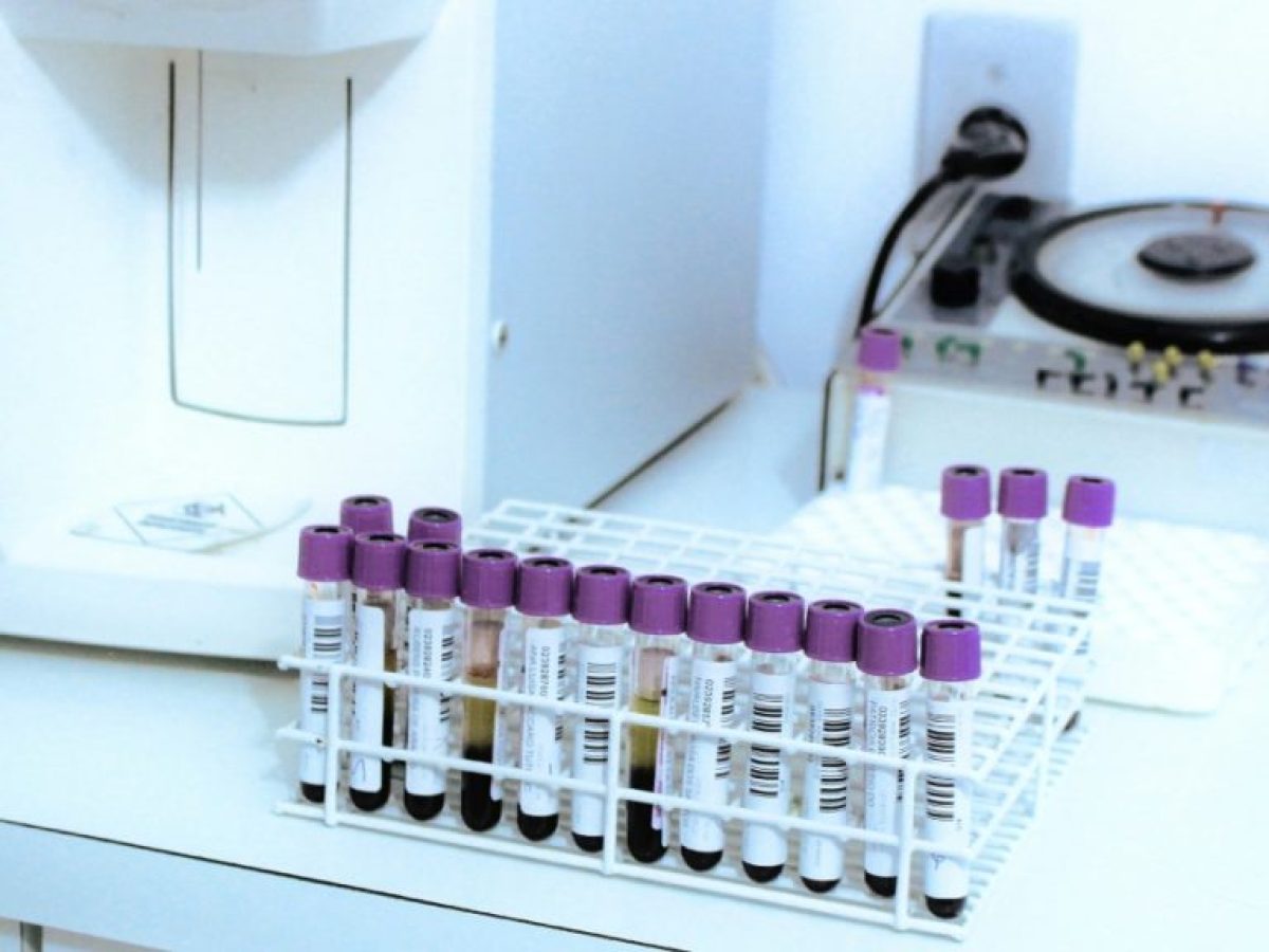 Νόσος του Crohn: Μια απλή εξέταση αίματος μπορεί να την προβλέψει χρόνια πριν από την εμφάνιση των συμπτωμάτων