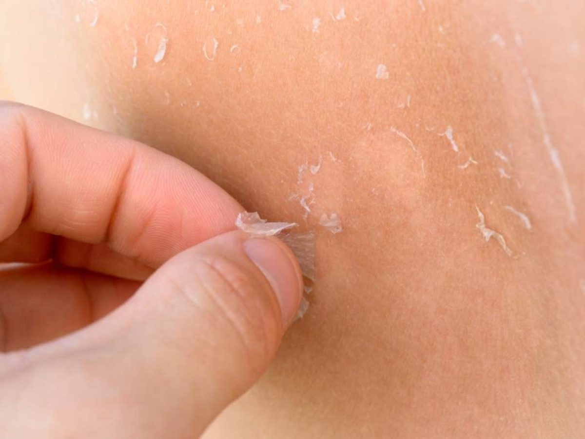 Πώς επηρεάζει ο χειμώνας το δέρμα και πώς να το προστατεύσετε