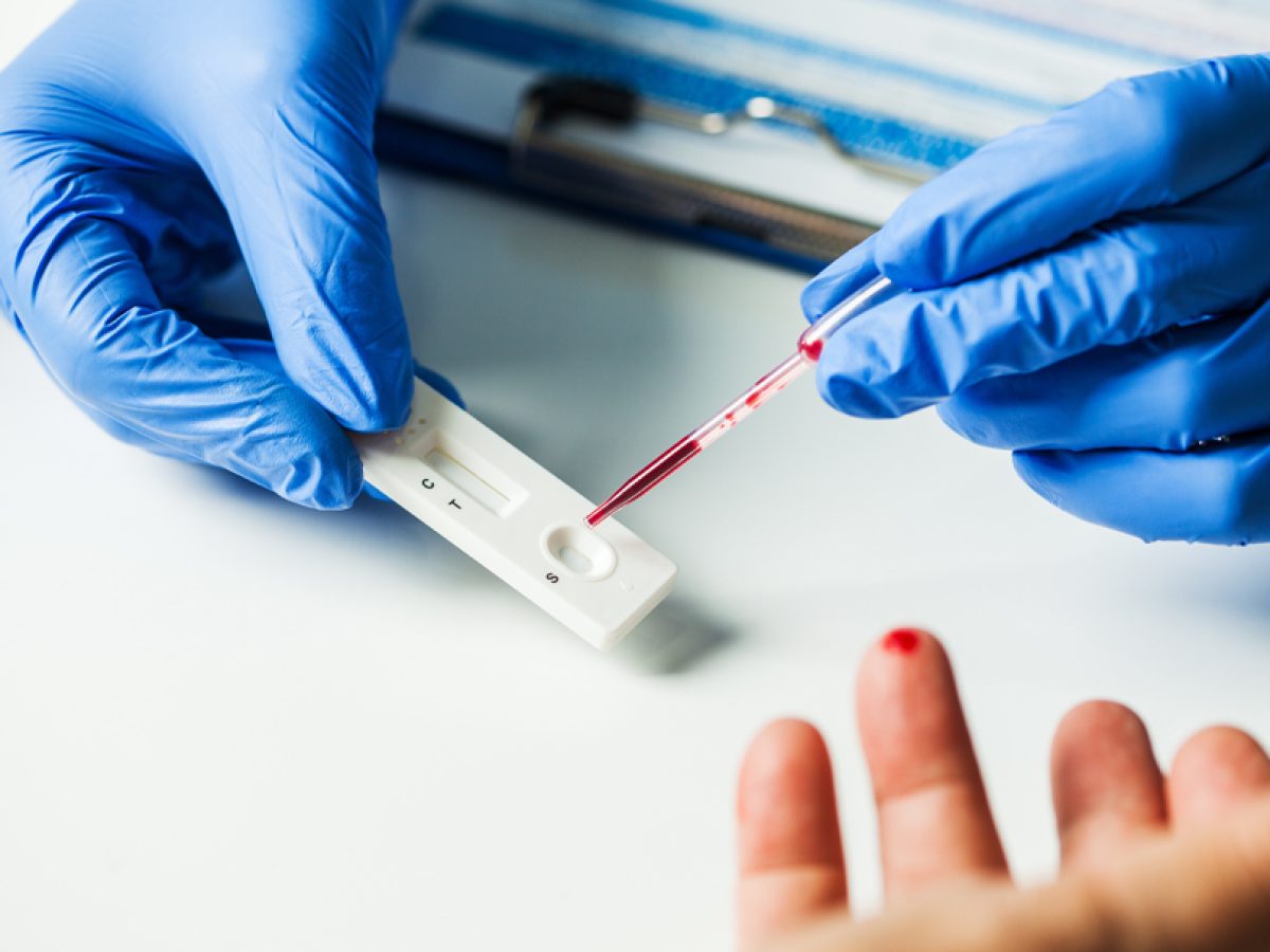 Το αυξημένο σάκχαρο συνδέεται με υψηλότερο κίνδυνο για Αλτσχάιμερ