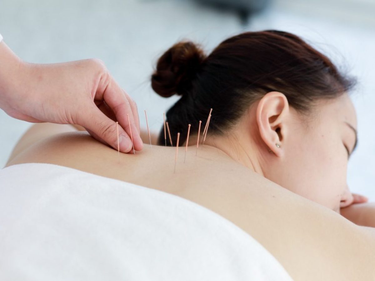 Βελονισμός κατά του άγχους: Μπορεί η κινεζική ιατρική να φέρει αποτέλεσμα;