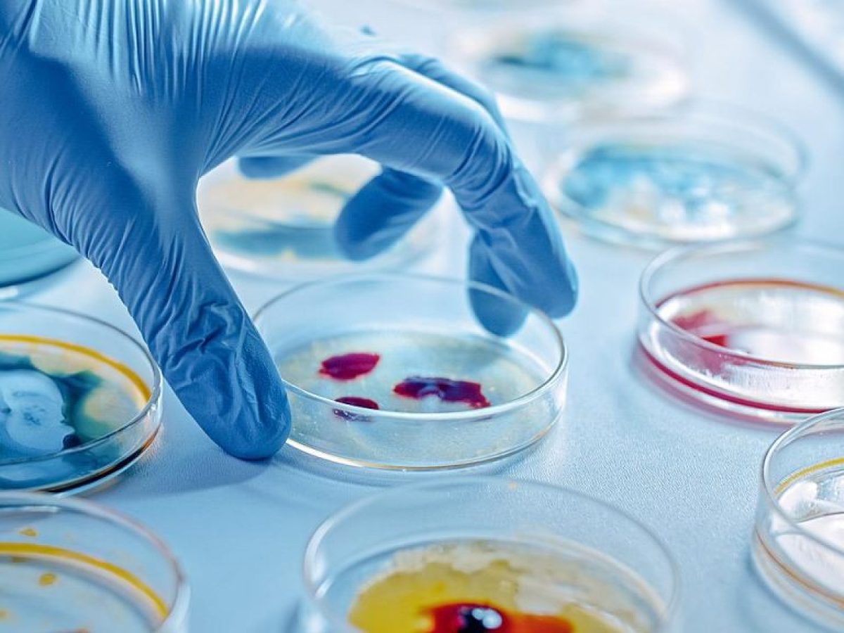 ECDC: Υψηλή μικροβιακή αντοχή σε ανθρώπους και ζώα στην Ελλάδα