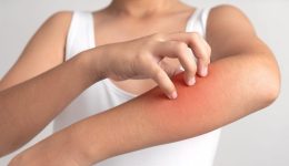 dermatikes-allergies-ke-i-amesi