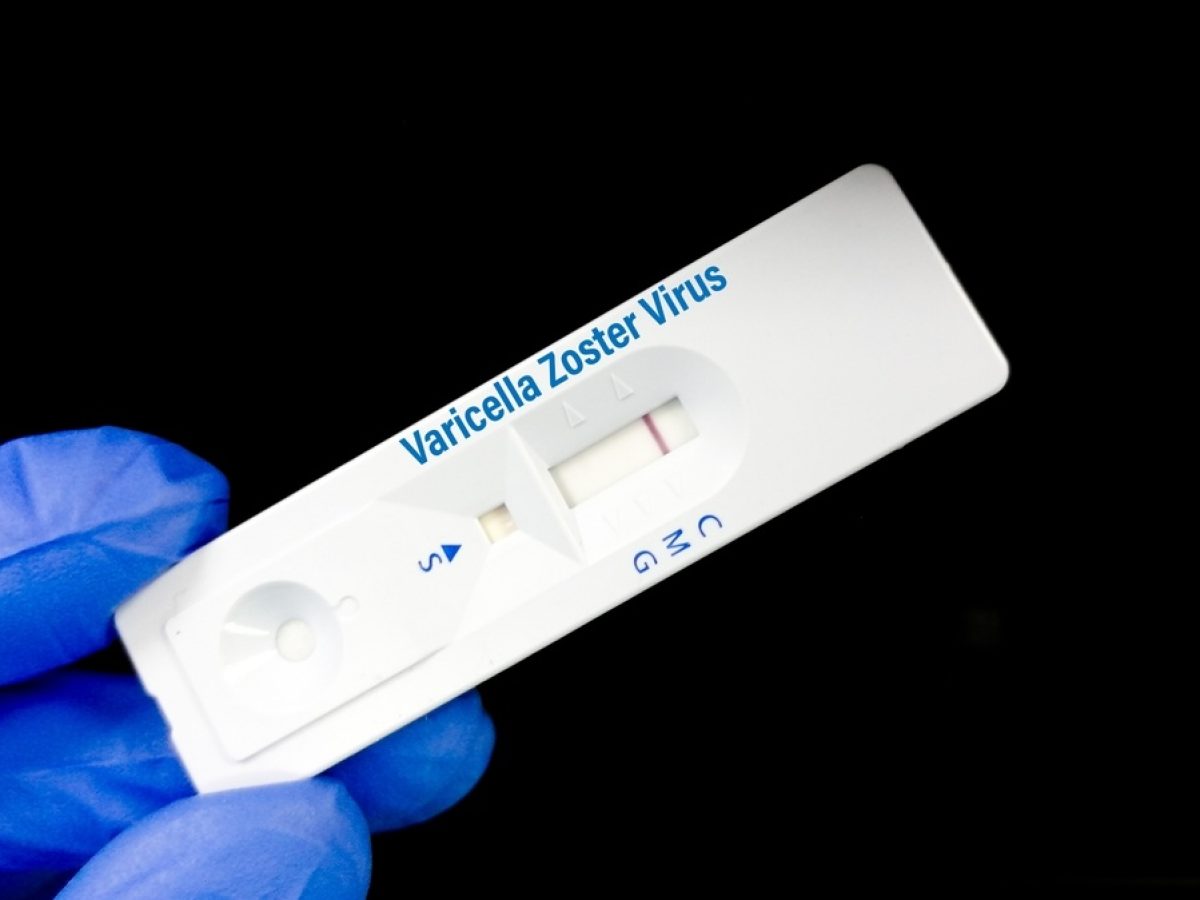 Έρπης Ζωστήρας: 1 στους 3 ενήλικες θα νοσήσει