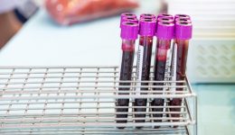 exelixis-sti-diagnosi-ke-therapia