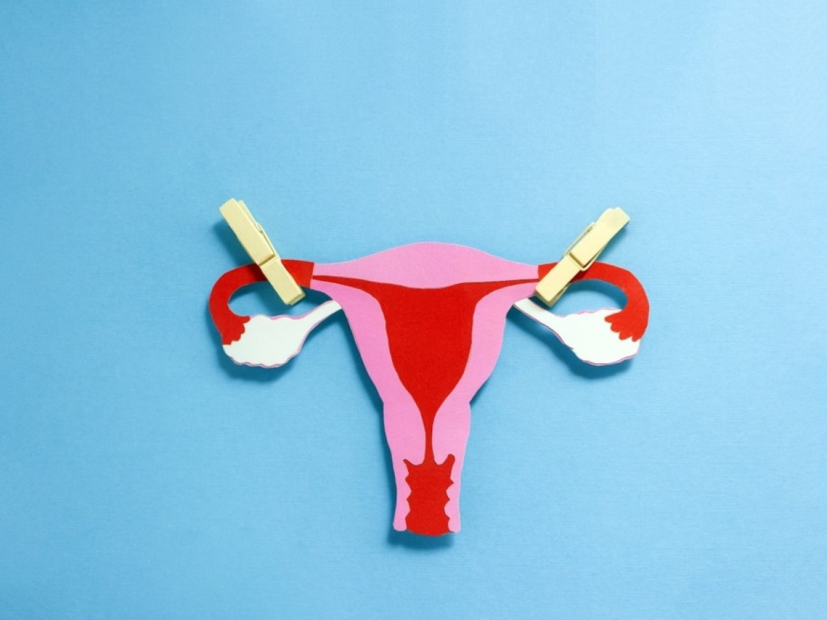 Η προληπτική σαλπιγγεκτομή ως μέσο πρόληψης του καρκίνου των ωοθηκών – Τι δείχνουν οι μελέτες