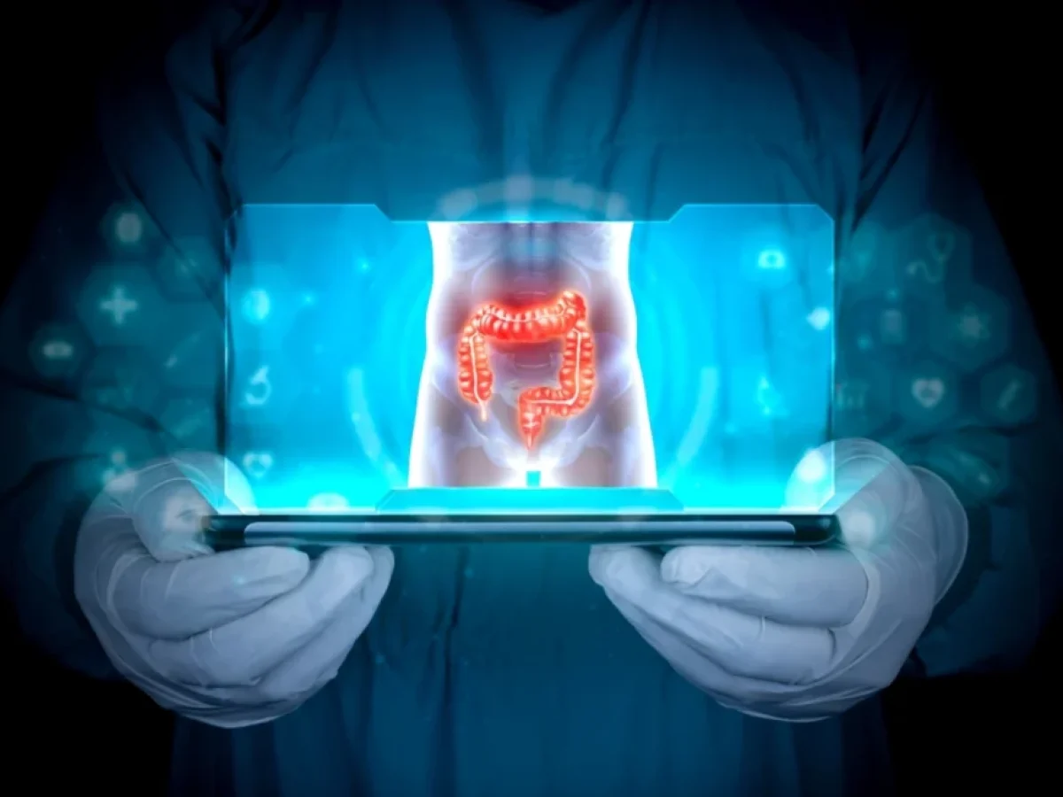 Καρκίνος παχέος εντέρου: Τα 4 πρώιμα συμπτώματα που εμφανίζονται πριν τα 50