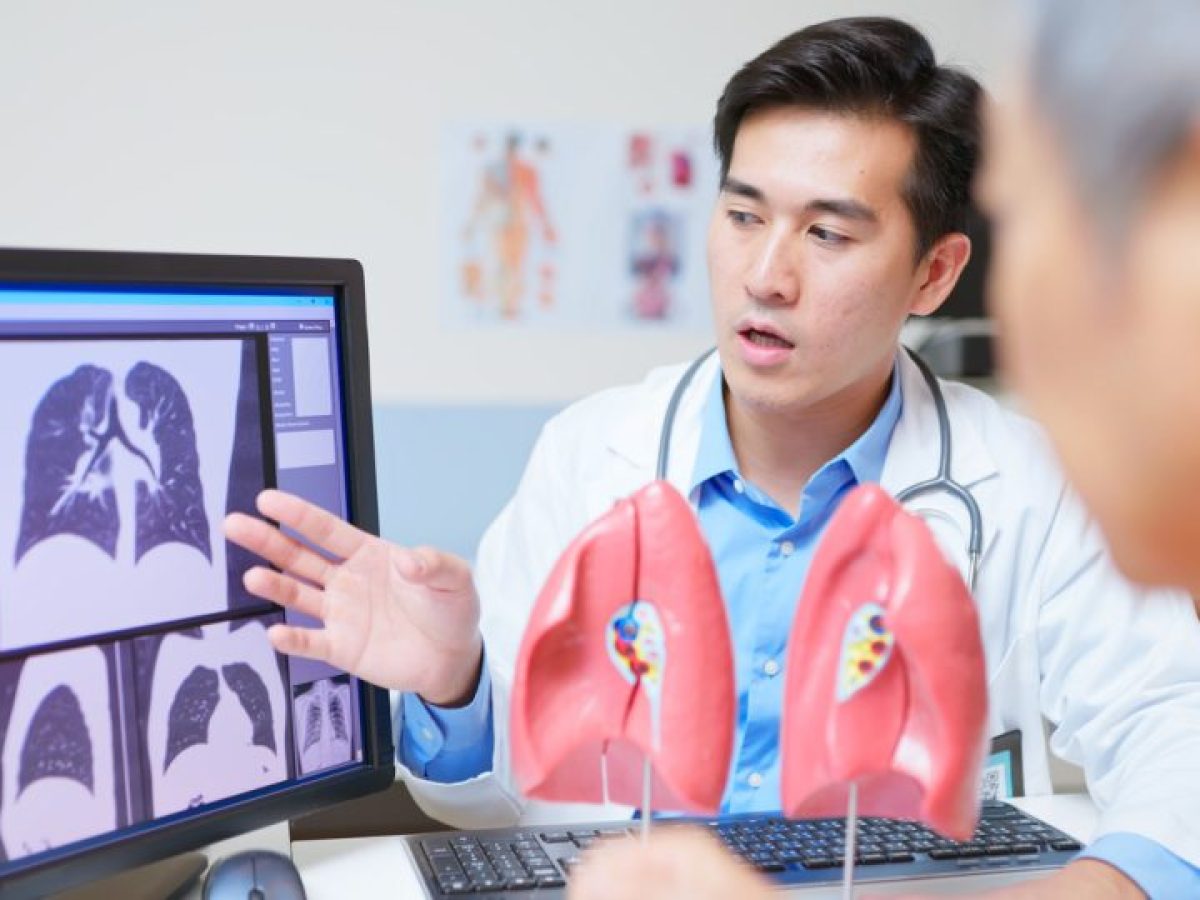 Καρκίνος του πνεύμονα: Το 80% των ασθενών δεν διαγιγνώσκονται εγκαίρως