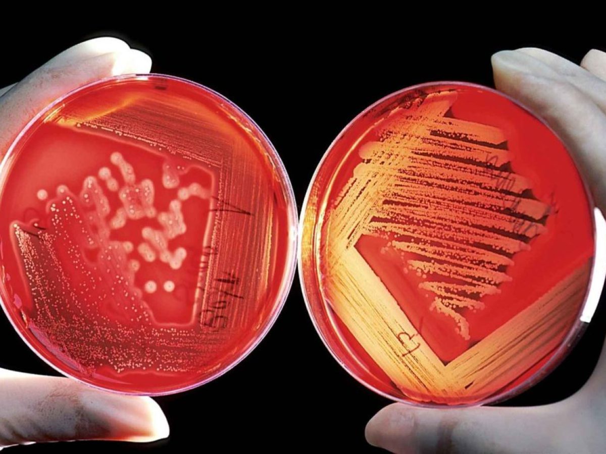 Κολπίτιδα: 3 “κόκκινες σημαίες” που δεν πρέπει να αγνοήσεις