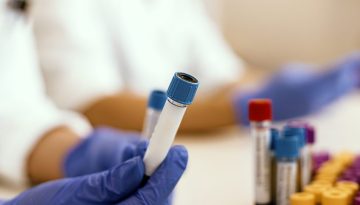 &Nu;ό&sigma;&omicron;&sigmaf; &Alpha;&lambda;&tau;&sigma;&chi;ά&iota;&mu;&epsilon;&rho;: &Alpha;&pi;&lambda;ή &epsilon;&xi;έ&tau;&alpha;&sigma;&eta; &alpha;ί&mu;&alpha;&tau;&omicron;&sigmaf; &upsilon;&pi;&omicron;&lambda;&omicron;&gamma;ί&zeta;&epsilon;&iota; &pi;ό&tau;&epsilon; &theta;&alpha; &alpha;&rho;&chi;ί&sigma;&omicron;&upsilon;&nu; &tau;&alpha; &sigma;&upsilon;&mu;&pi;&tau;ώ&mu;&alpha;&tau;ά &tau;&eta;&sigmaf;