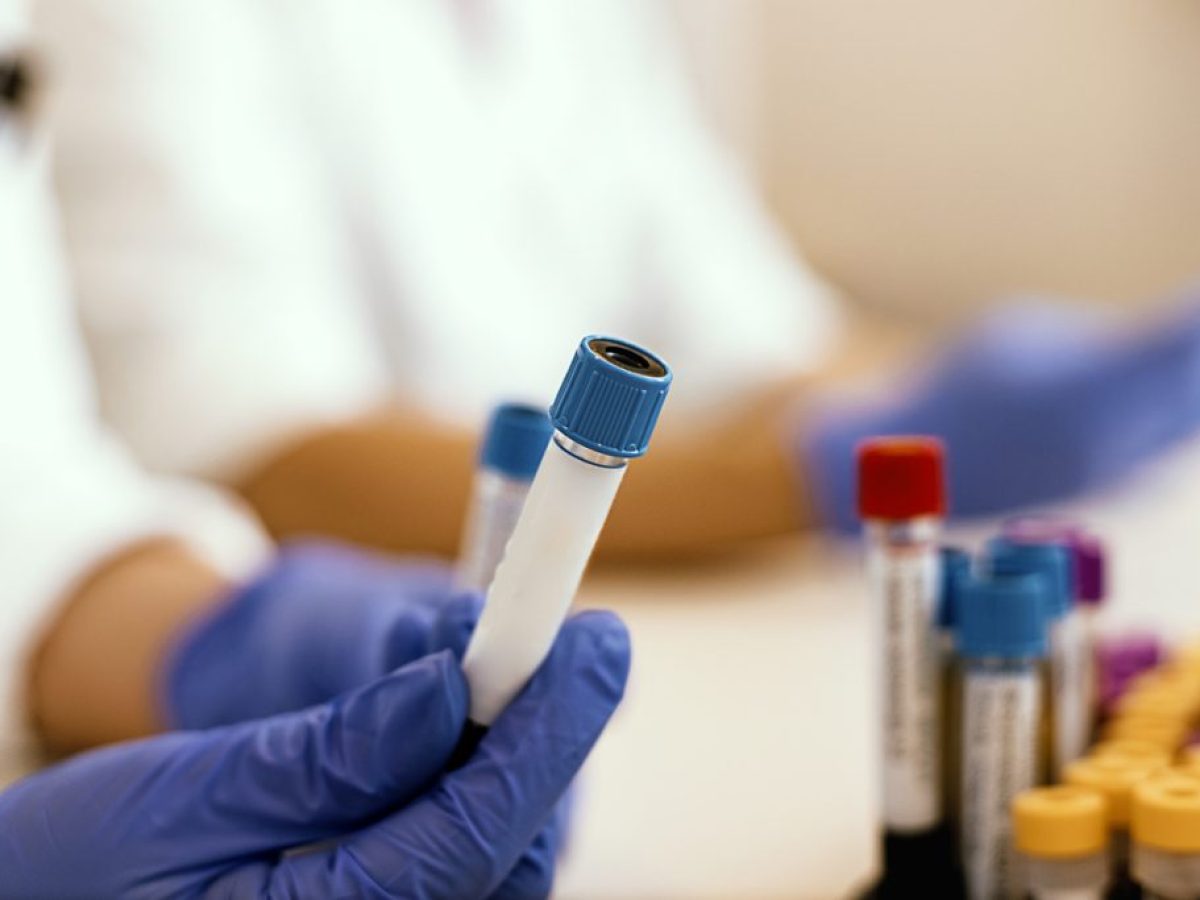 Νόσος Αλτσχάιμερ: Απλή εξέταση αίματος υπολογίζει πότε θα αρχίσουν τα συμπτώματά της