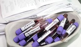 prolamvano-dorean-proliptikes-exetasis-gia