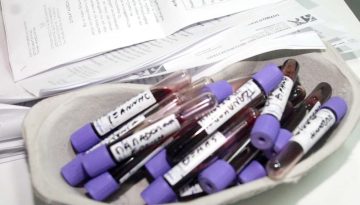 &ldquo;&Pi;&rho;&omicron;&lambda;&alpha;&mu;&beta;ά&nu;&omega;&rdquo;: &Delta;&omega;&rho;&epsilon;ά&nu; &pi;&rho;&omicron;&lambda;&eta;&pi;&tau;&iota;&kappa;έ&sigmaf; &epsilon;&xi;&epsilon;&tau;ά&sigma;&epsilon;&iota;&sigmaf; &gamma;&iota;&alpha; &tau;&eta; &nu;&epsilon;&phi;&rho;&iota;&kappa;ή &delta;&upsilon;&sigma;&lambda;&epsilon;&iota;&tau;&omicron;&upsilon;&rho;&gamma;ί&alpha;