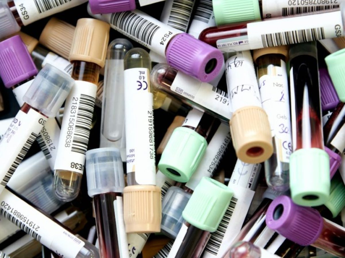 Σοβαρές ελλείψεις αίματος απειλούν εκατοντάδες ασθενείς με Θαλασσαιμία