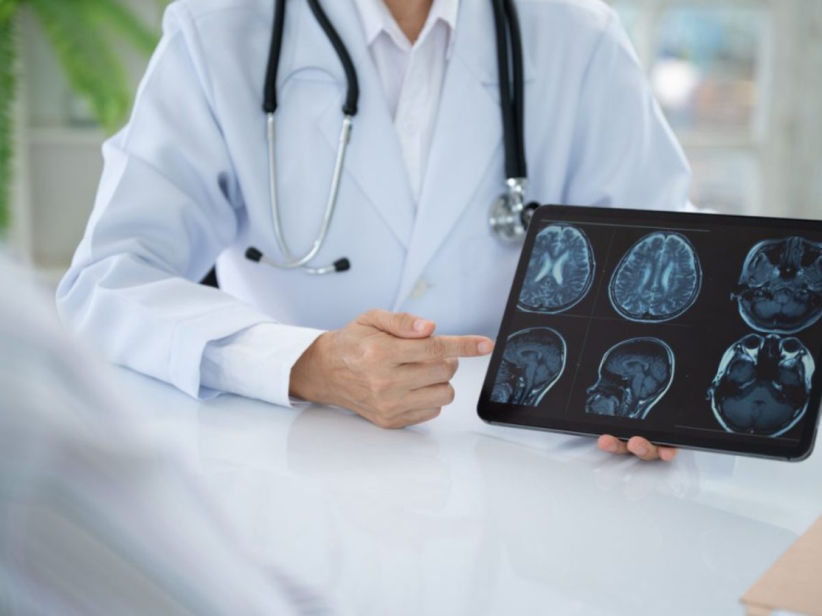 16% μείωση του κινδύνου άνοιας, με φάρμακα για την οστεοπόρωση – Νέα μεγάλη μελέτη