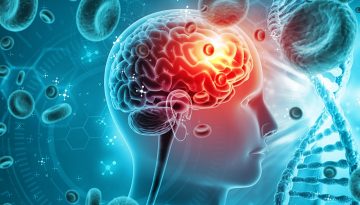 AI: Προβλέπει το Αλτσχάιμερ με 93% ακρίβεια