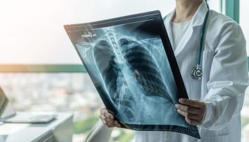 ΕΜΑ: Νέα θεραπεία για υποτροπιάζοντα μικροκυτταρικό καρκίνο του πνεύμονα