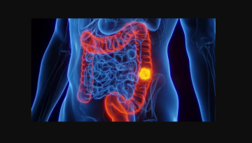 Επιστήμονες ζητούν απαγόρευση του μπέικον στα σούπερ μάρκετ λόγω χημικής ουσίας που συνδέεται με 50.000 περιπτώσεις καρκίνου