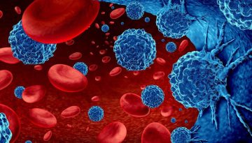 Πολλαπλό μυέλωμα: Νέα γενιά φαρμάκων δημιουργεί ελπίδες