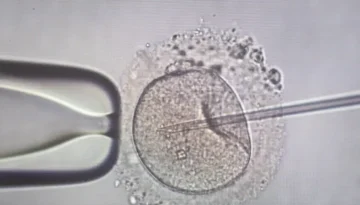 Τι δείχνει έρευνα του πανεπιστημίου της Οξφόρδης για τη συχνή εκσπερμάτιση