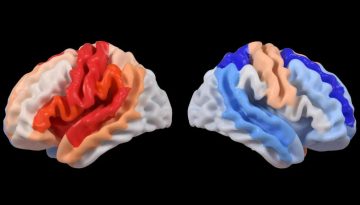 Εγκεφαλικό επεισόδιο: Η «κρυφή» αναζωογόνηση του εγκεφάλου στην προσπάθεια για ανάρρωση