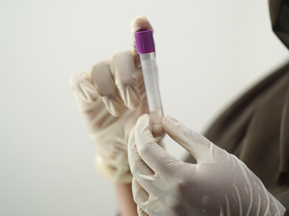 Ελπίδα για έγκαιρη διάγνωση: Τεστ αίματος εντοπίζει βλάβες στο ήπαρ πριν εξελιχθούν σε καρκίνο