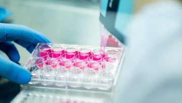 Η νέα προσέγγιση στον καρκίνο του προστάτη που μειώνει τις παρενέργειες της βασικής θεραπείας