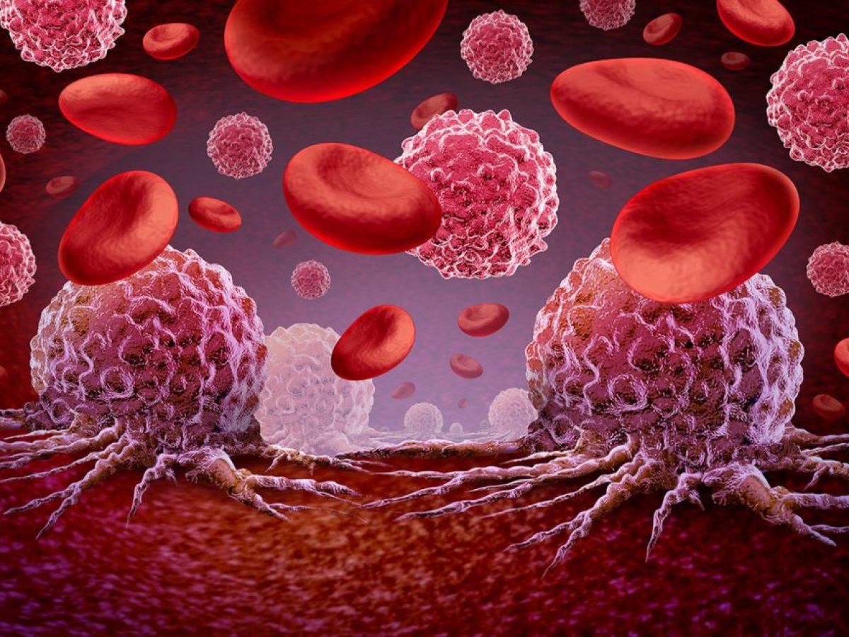 Η πρώιμη έκθεση των παιδιών στα «αιώνια χημικά» συνδέεται με κίνδυνο εμφάνισης λευχαιμίας