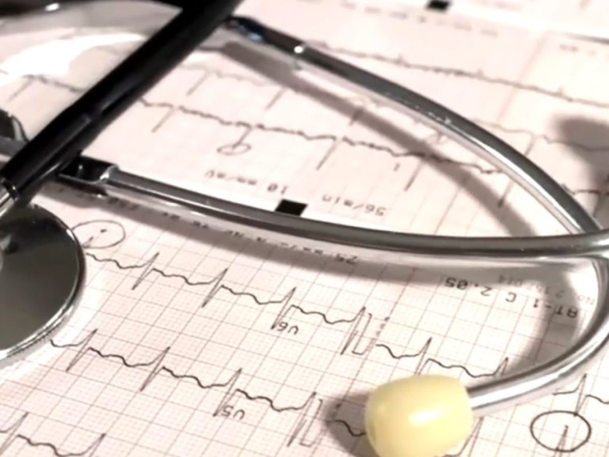 Κολπική μαρμαρυγή: Γιατί αυξάνονται τα ποσοστά στους νέους