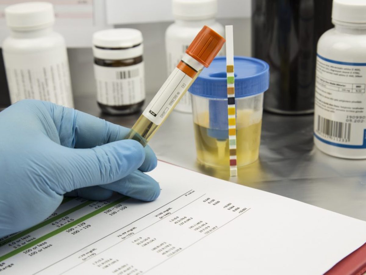 Νέο rapid τεστ μπορεί να ανιχνεύει σε λίγες ώρες τις ουρολοιμώξεις