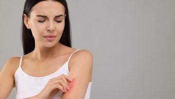 Ατοπική δερματίτιδα: Λιγότερο άγχος, λιγότερες εξάρσεις;