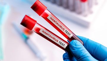 Ευρώπη: Πόσο προετοιμασμένη είναι για τις νέες υγειονομικές απειλές;