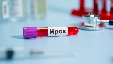 Ήπειρος: Πρώτο κρούσμα ευλογιάς των πιθήκων (mpox)