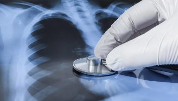 Βρέθηκε νέος προστατευτικός παράγοντας των πνευμόνων