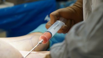 &Epsilon;&pi;&epsilon;&mu;&beta;ά&sigma;&epsilon;&iota;&sigmaf; &omicron;&mu;&omicron;&rho;&phi;&iota;ά&sigmaf; &chi;&omega;&rho;ί&sigmaf; &gamma;&iota;&alpha;&tau;&rho;&omicron;ύ&sigmaf;: &Nu;&epsilon;&kappa;&rho;&omicron;ί, &sigma;&eta;&psi;&alpha;&iota;&mu;ί&alpha; &kappa;&alpha;&iota; &sigma;&omicron;&kappa;&alpha;&rho;&iota;&sigma;&tau;&iota;&kappa;έ&sigmaf; &alpha;&pi;&omicron;&kappa;&alpha;&lambda;ύ&psi;&epsilon;&iota;&sigmaf; &gamma;&iota;&alpha; &tau;&alpha; &pi;&alpha;&rho;ά&nu;&omicron;&mu;&alpha; fillers